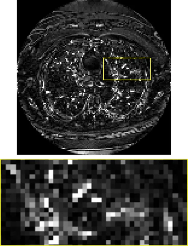 CT: 4×4 residual