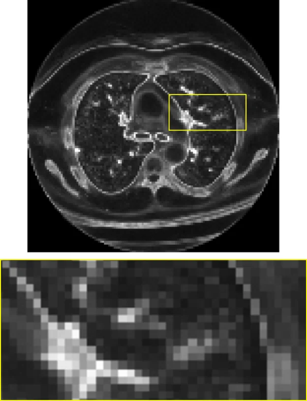 CT: 4×4 std. (N = 64)